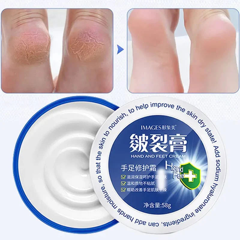 IMAGES Chinese Traditional Anti-drying Oil Glycerin To Reduce Dry Lines Moisturizing Hand And Feet Cream IMAGES Chinese Traditional Anti-drying Oil Glycerin To Reduce Dry Lines Moisturizing Hand And Feet Cream