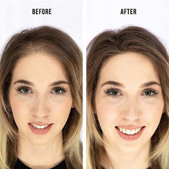 Dexe Hair Building Fibers 22g | For Men & Women