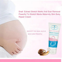 Aichun Beauty Anti Stretch Pregnancy Mark Scar Removal Cream - 60gm