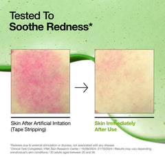 Anua Azelaic Acid 10+ Hyaluron Redness Soothing Serum - 30ml