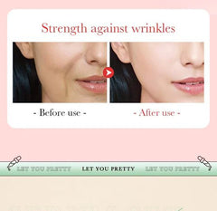 Bioaqua 3pcs/set Turmeric Snail Nicotinamide Moisturizing Face Serum - 30ml