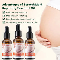 KORMESIC Skincare for Natural Belly Care Remover Stretch Mark Oil - 100ml