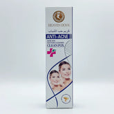 Heaven Dove Anti Acne Cream – 50g