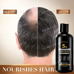 KORMESIC Minoxidil with Biotin Hair Grower Shampoo - 300ml