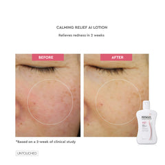 Physiogel Calming Relief A.i Lotion 200ml