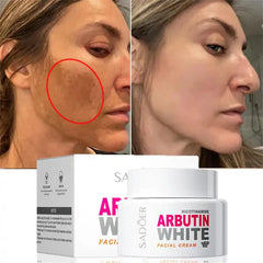 Sadoer Nicotinamide Arbutin White Facial Cream 50g