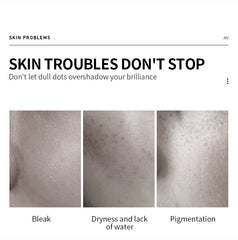 VEZE Moisturizing for the face, pore reduction, freckles, and smooth - 100ml