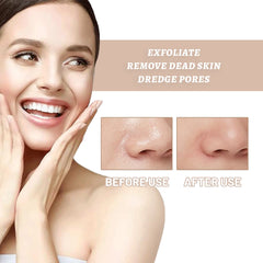 Lakme Rose Face & Body Exfoliating Gel - 100g