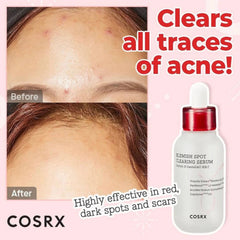 Cosrx Blemish Spot Clearing Serum - 40ml