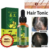 Aichun Beauty 7 Days Ginger Hair Growth Oil Serum For Damaged Hair - 30ml