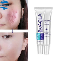 BIOAQUA- Acne Removal Pure Skin Cream 30g