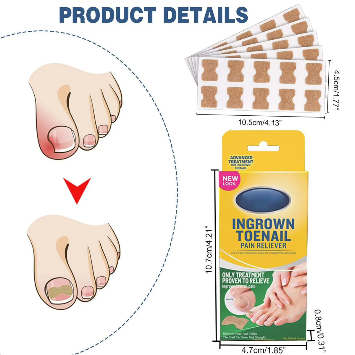 Royal Prestige Ingrown Toenail Pain Reliever 30 Patches