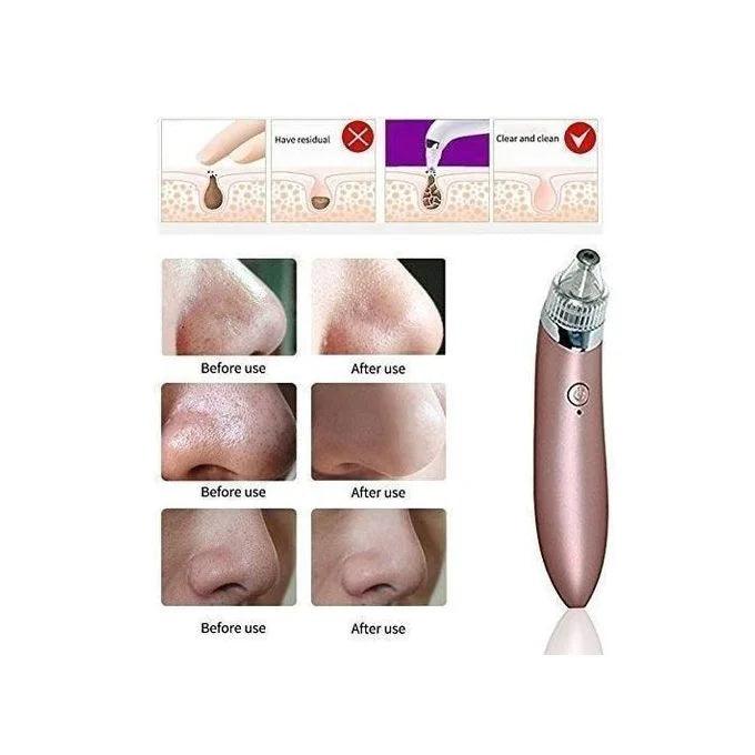 5 in 1 Blackhead Vacuum Acne Cleaner Pore Remover Skin