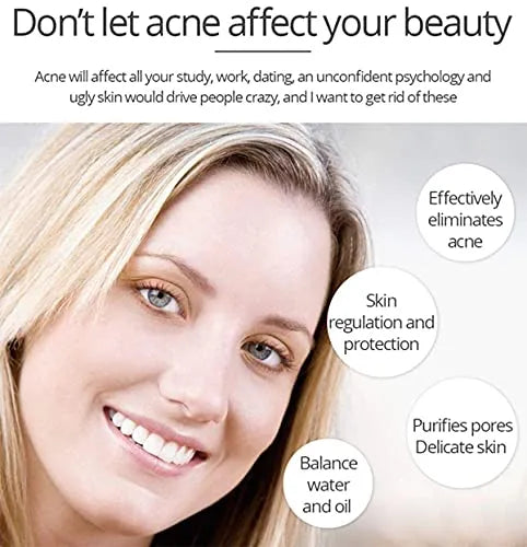 Aichun beauty Anti Acne Whitening Facial Serum - 30ml