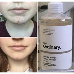 The Ordinary Glycolic Acid 7% Toning Solution