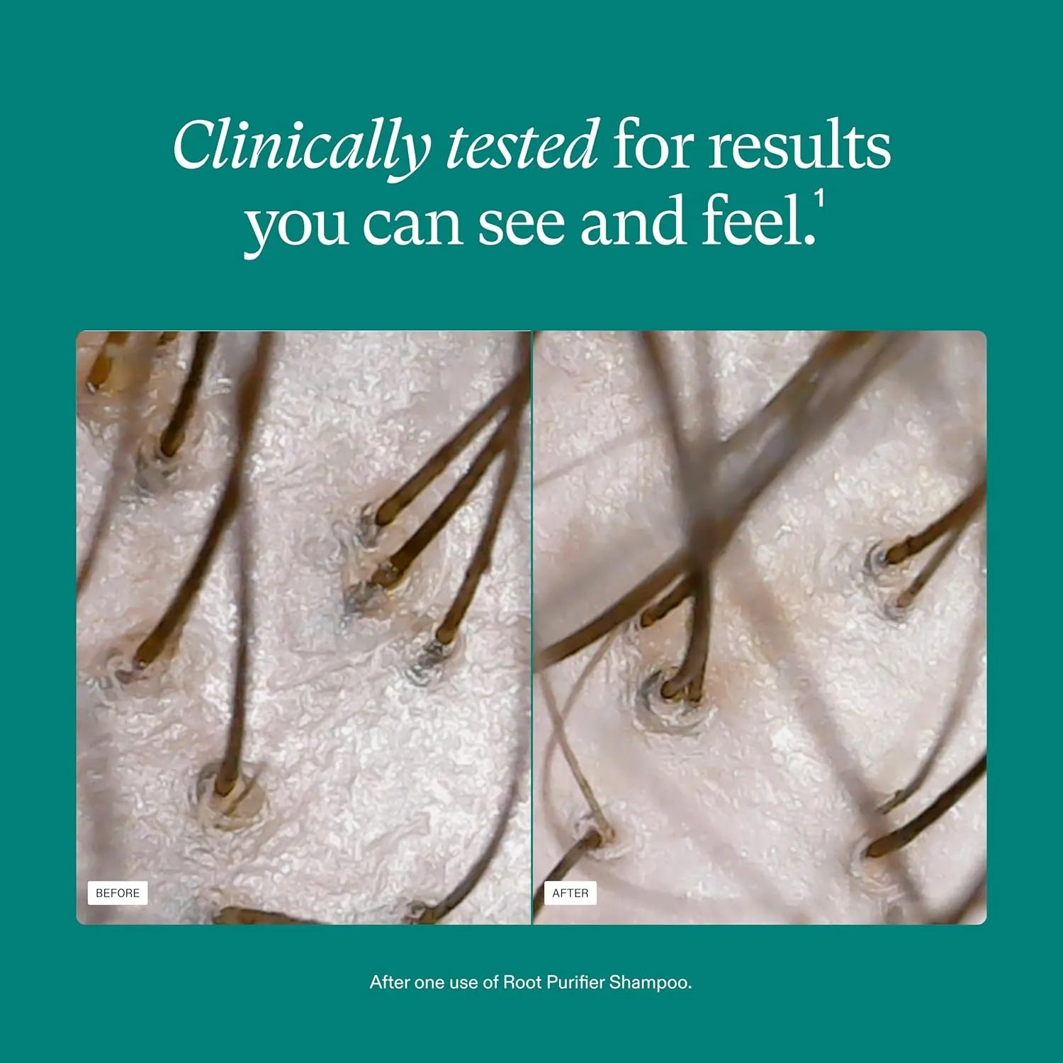 Nutrafol Root Purifier Scalp Microbiome Shampoo - 240ml