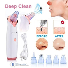 5 in 1 Multi‑functional Black Head Removal Machine
