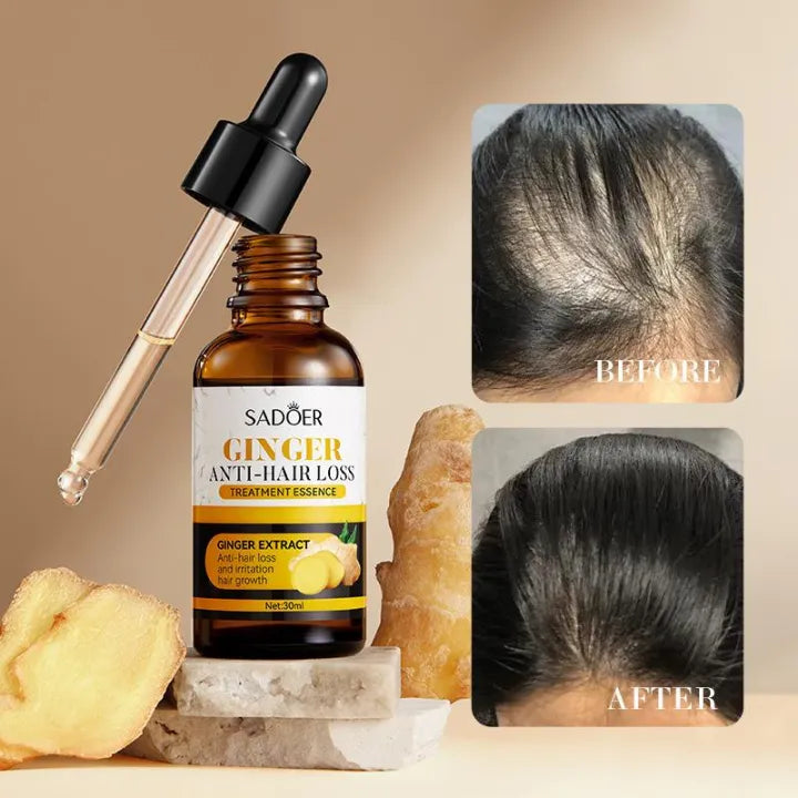 Sadoer Hair Growth Serum Ginger Essence Hair Care Oil 30ml