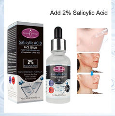 AICHUN BEAUTY  Salicylic Acid Purifying Shrink Pores Exfoliation Anti-Acne Face Serum - 30ml