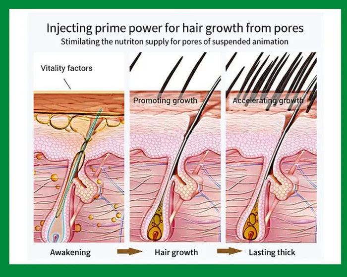 Aichun Beauty 7 Days Ginger Hair Shampoo - 200ml