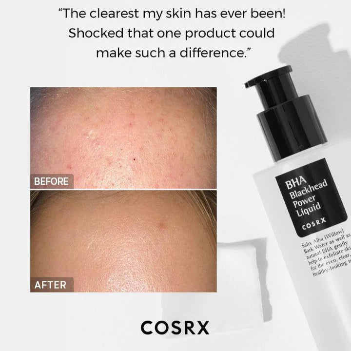 COSRX - BHA Blackhead Power Liquid 100ml