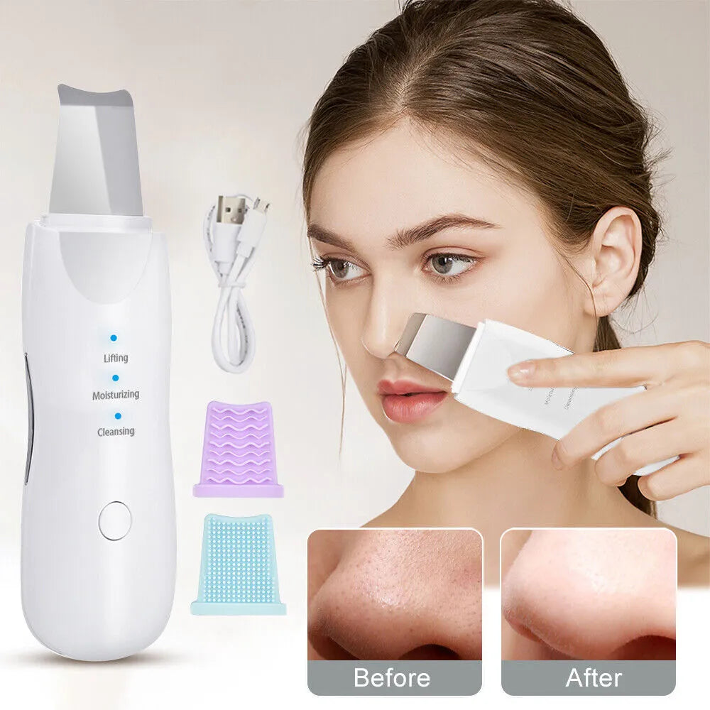 Blackhead Machine Face Scrubber Machine For Blackhead – Ameena.pk