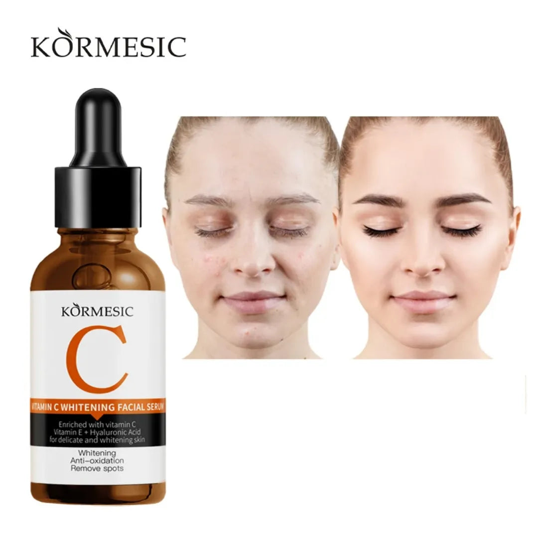 KORMESIC Vitamin C Whitening Facial Serum - 30ml