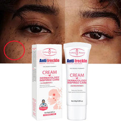 Aichun Beauty Remove Freckles Dark Spots Anti-Freckle Cream