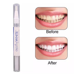 Professional Teeth Whitening & Stain Removing Pen