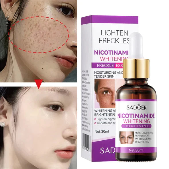 Sadoer Niacinamide Whitening Freckles Serum 30ml