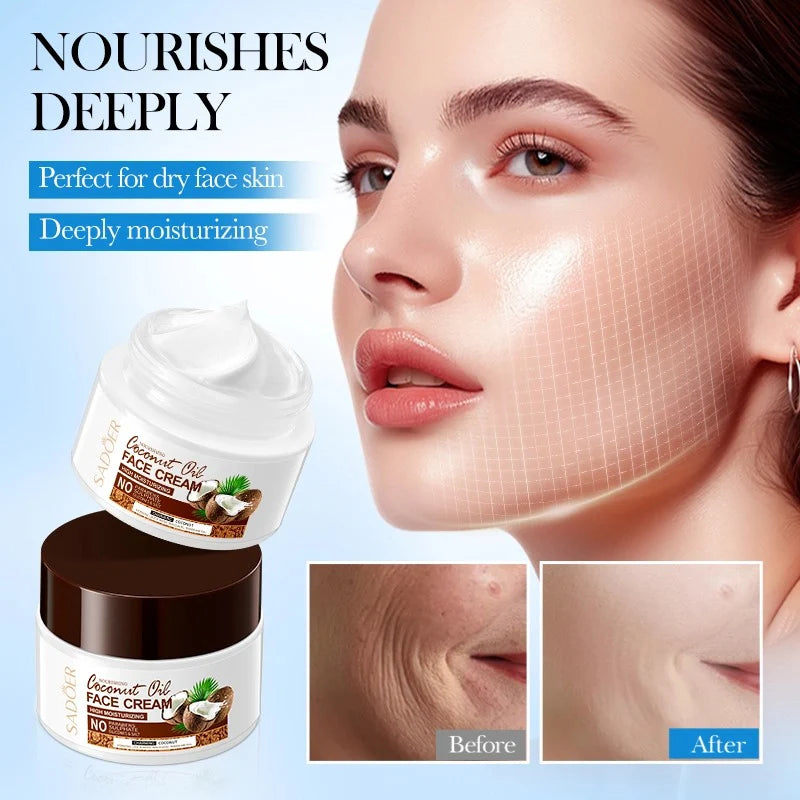 SADOER Nourishing Coconut Oil Moisturizing Face Cream  - 50gm