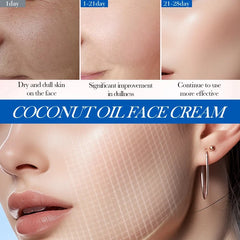 SADOER Nourishing Coconut Oil Moisturizing Face Cream  - 50gm