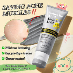 Sadoer Salicylic Acid Amino Acid Acne Removal Brightening Dual Action Facial Cleanser 50g