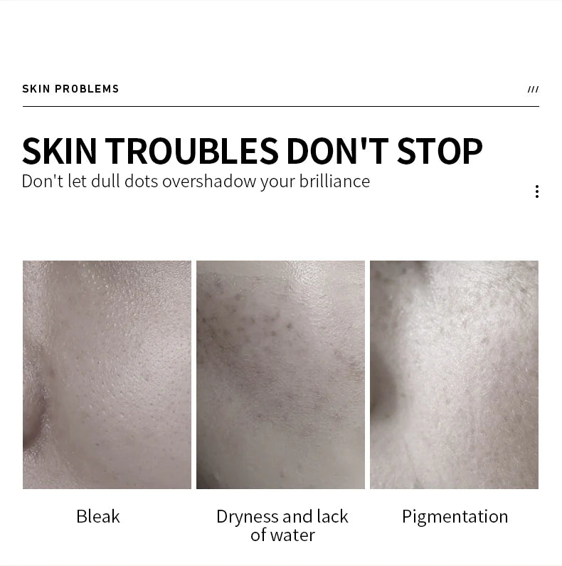 VEZE Moisturizing for the face, pore reduction, freckles, and smooth - 100ml