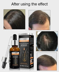Hair Growth Essential Oil – Biotin Cold-Pressed DHT Blocker – 30ml (Anti Hair Loss)