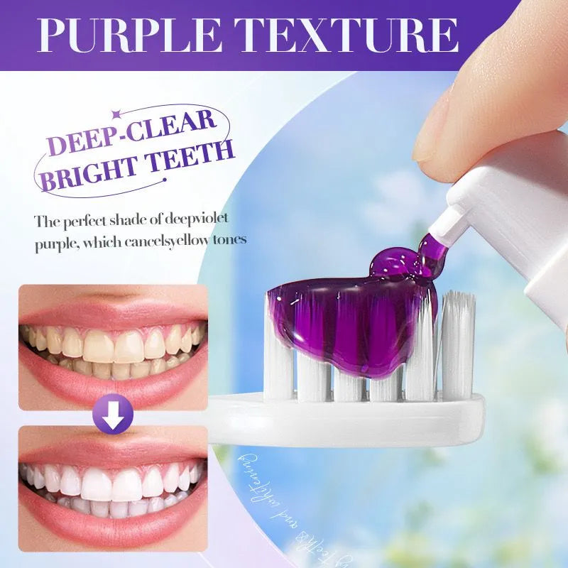 Sadoer V34 Remove Yellow Teeth Stains Whitening Toothpaste – 28 ml