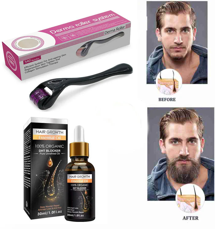 Pack Of 02 Hair Growth Oil Derma Roller - 0.55mm