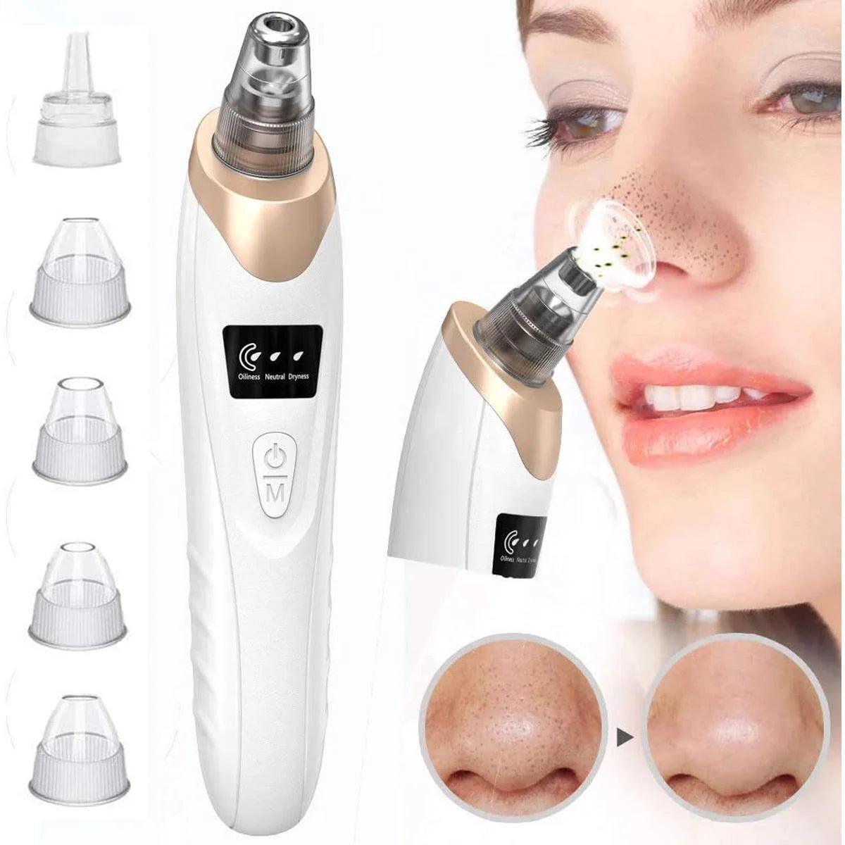 5 in 1 Blackhead Vacuum Acne Cleaner Pore Remover Skin