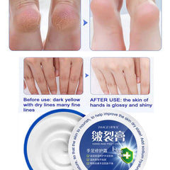 IMAGES Chinese Traditional Anti-drying Oil Glycerin Moisturizing Hand Feet Cream - 58gm