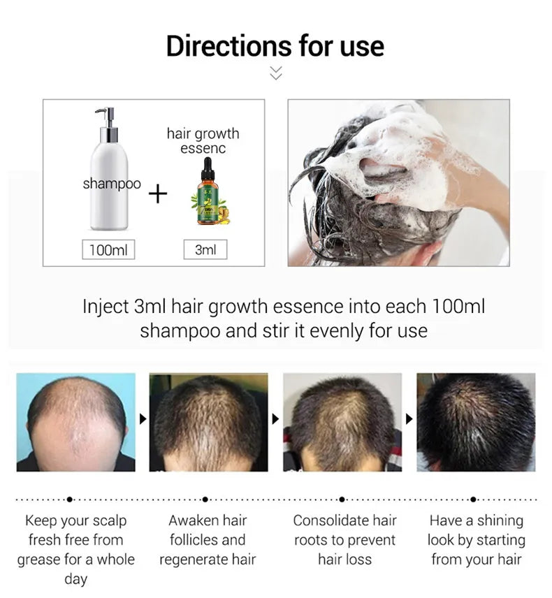 Aichun Beauty 7 Days Ginger Hair Growth Oil Serum For Damaged Hair - 30ml
